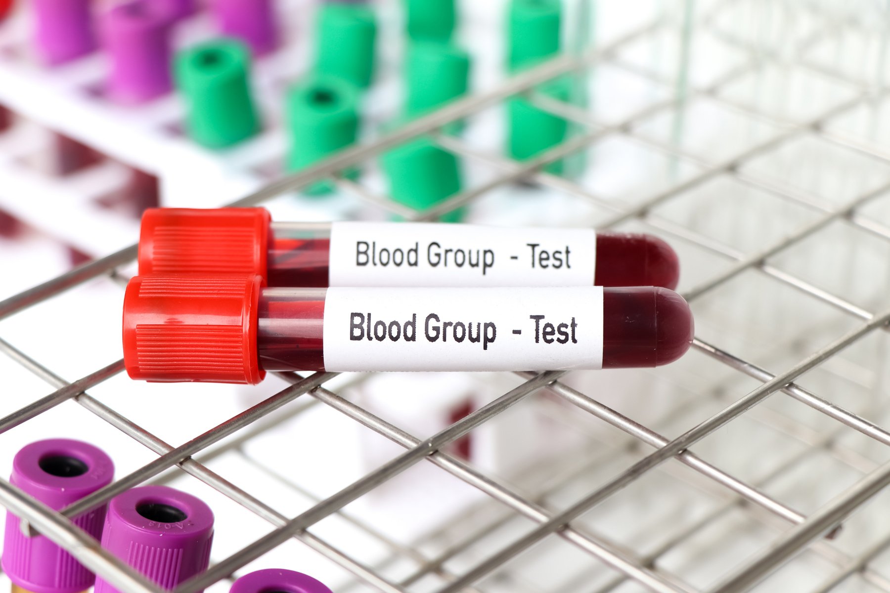 Blood Group test, blood sample to analyze in the laboratory